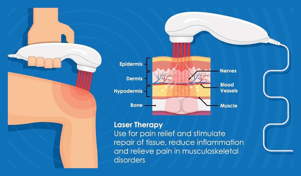 The image is a digital illustration of a medical device, specifically a laser therapy machine, with annotations explaining its components and their functions.