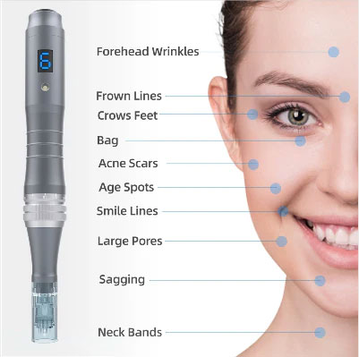 The image displays a device labeled  Forehead Wrinkles  with various features highlighted, such as  6  for the number of lines,  Frown Lines,   Crows Feet,   Age Spots,  and  Large Pores.  It is placed on a woman s face, showing the results of its use. The device appears to be an anti-aging tool with multiple functions.
