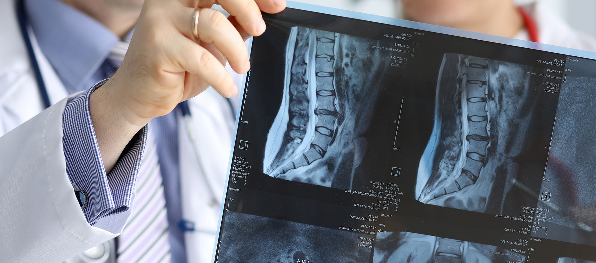 A medical professional, likely a radiologist, examining an X-ray film with various images of a patient s spine.